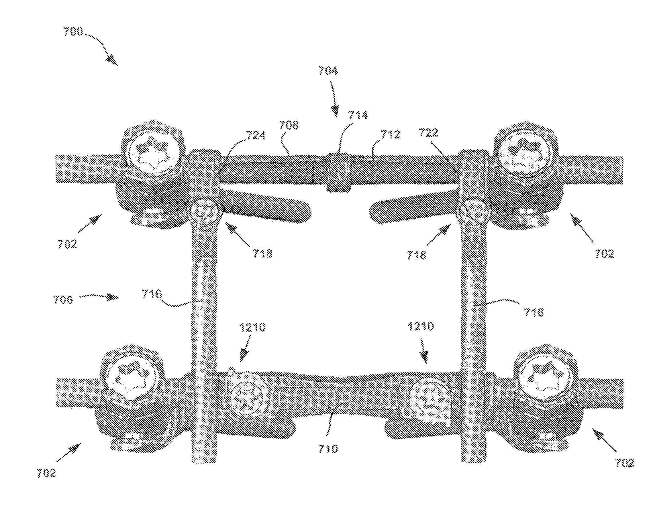 Deflection rod system for a spine implant including an inner rod and an outer shell and method