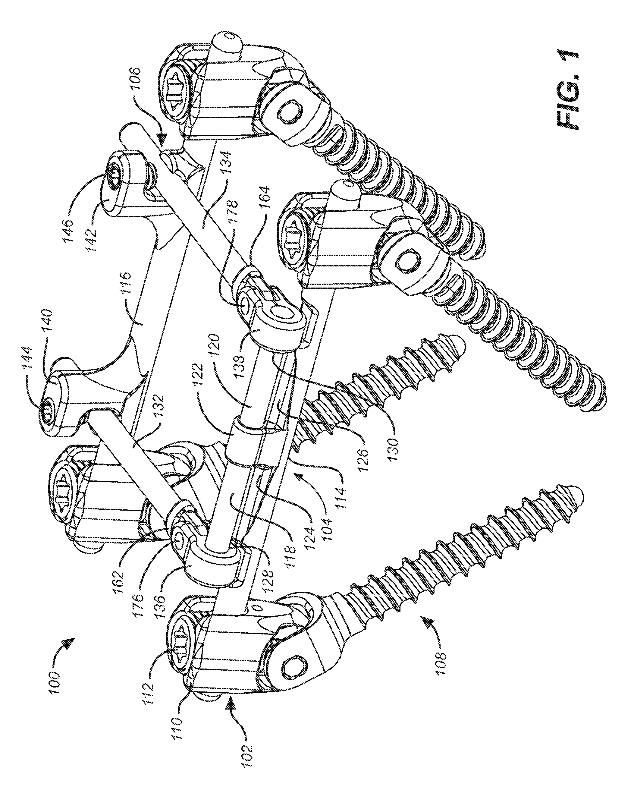 Deflection rod system for a spine implant including an inner rod and an outer shell and method