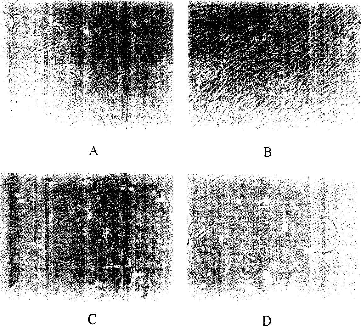 Method for sorting human marrow mesenchymal stemcell by monoclonal antibody ZUF10 immunomagnetic bead