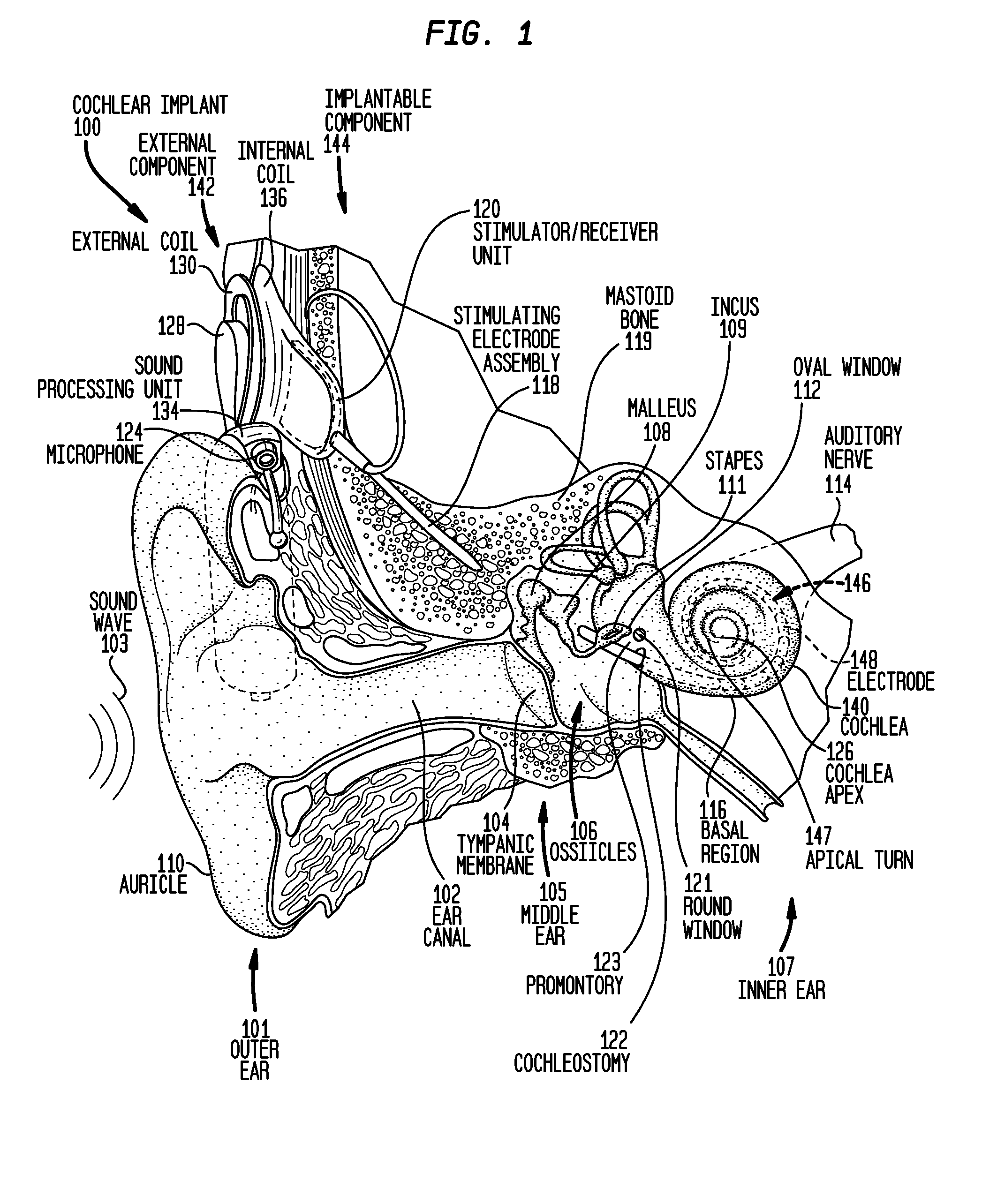 Implantable device migration control