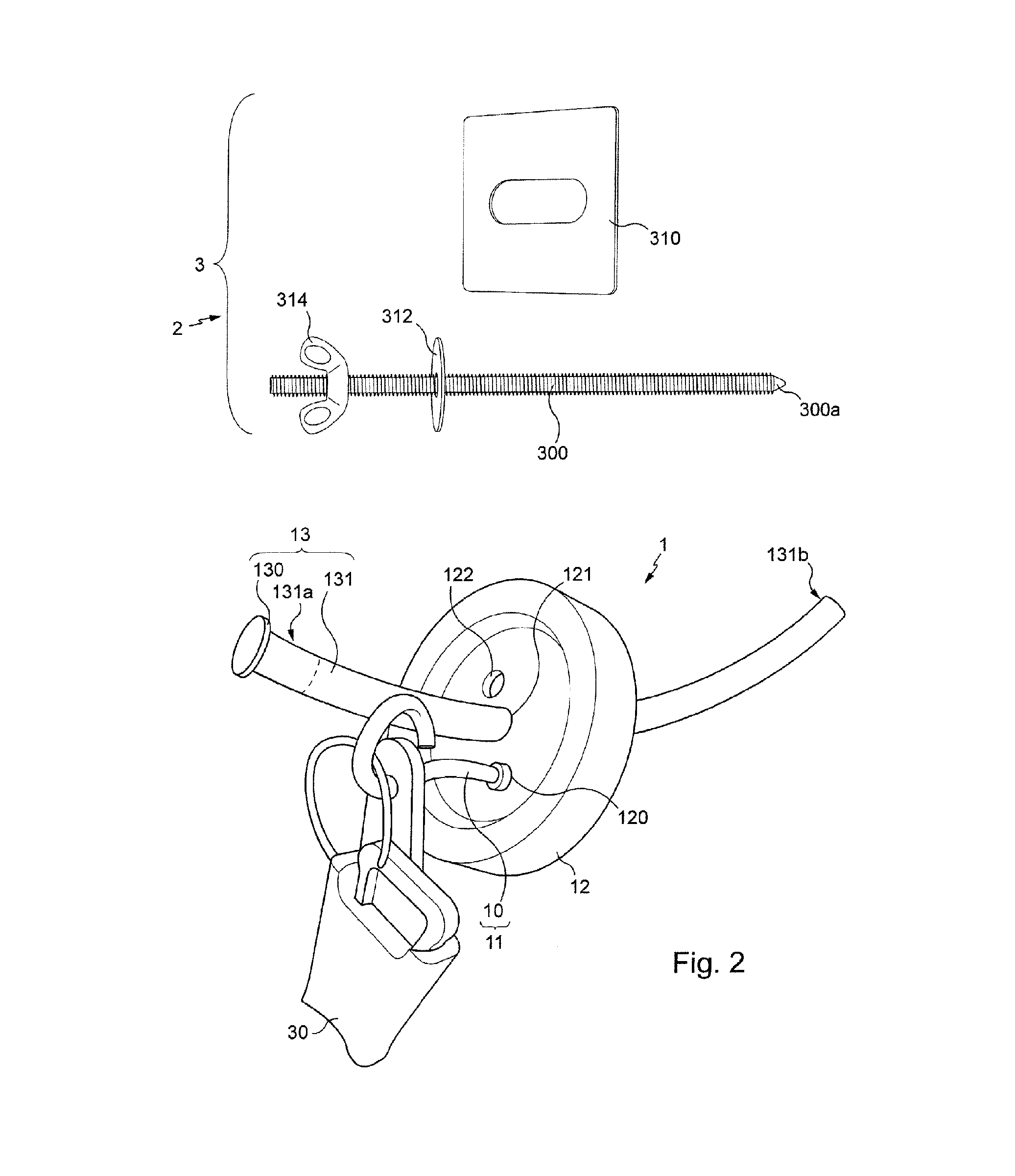 Device, kit and method for anchoring an element on an exterior face of a wall of a building