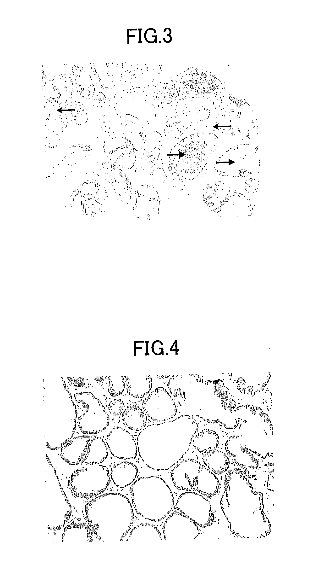 Therapeutic agent for a lower urinary tract disease and an agent for improving a lower urinary tract symptom