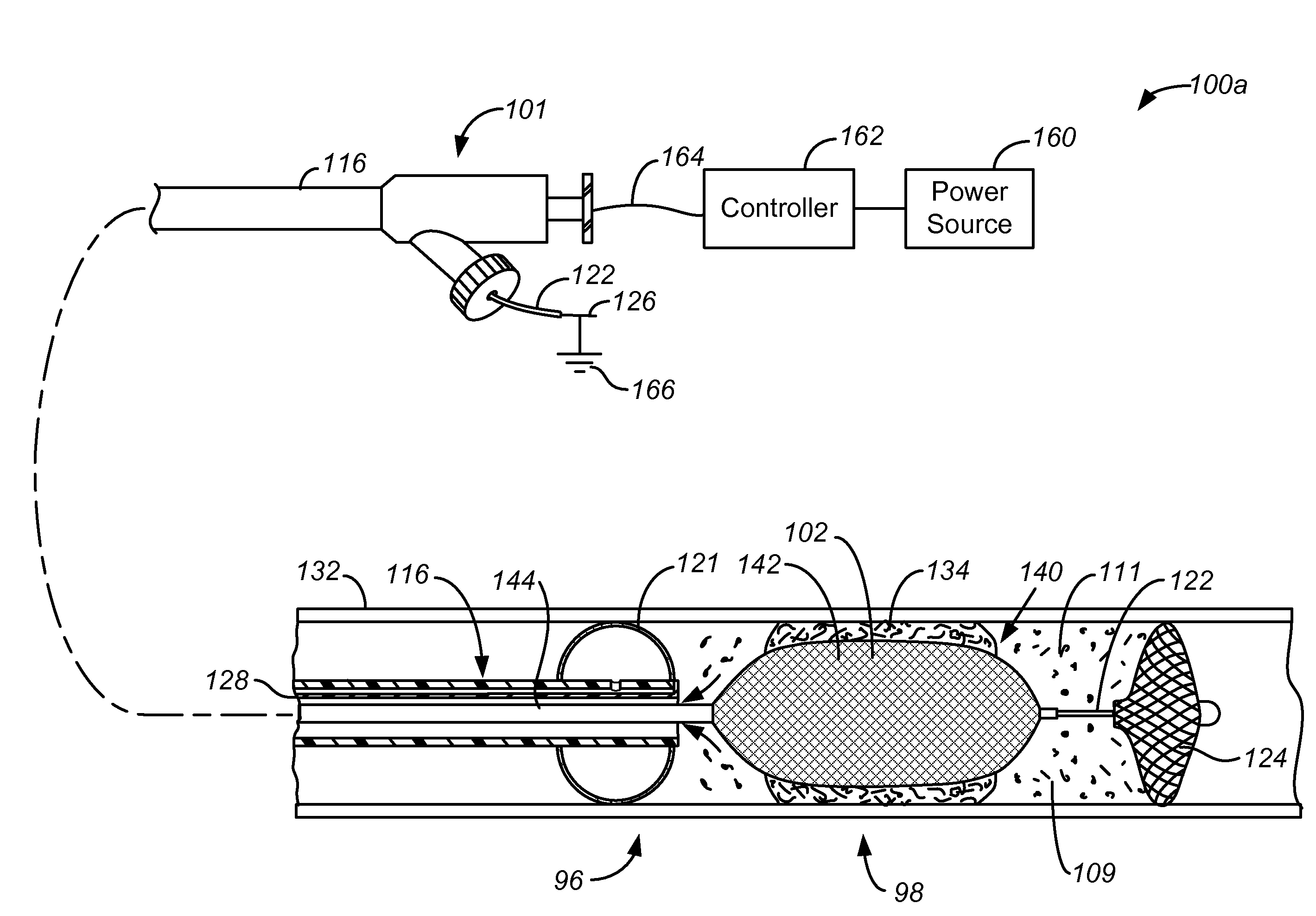 Method for treating a target site in a vascular body channel