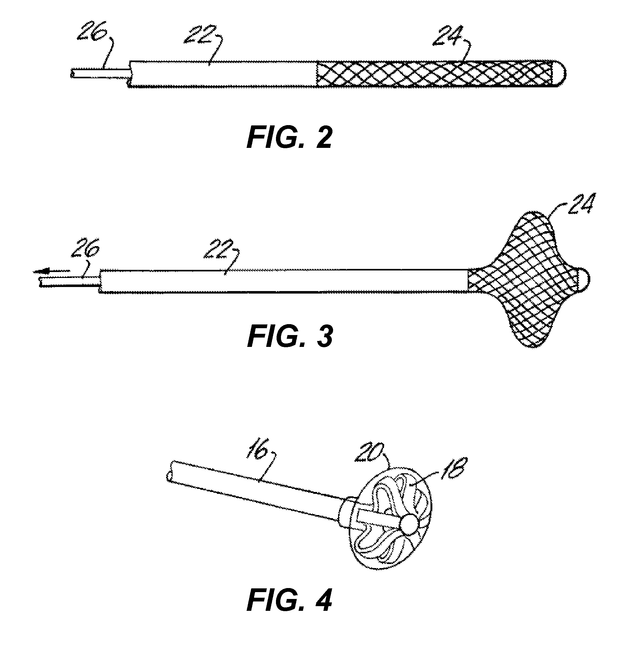 Method for treating a target site in a vascular body channel