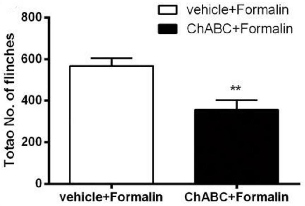 Application of chondroitin sulfatase in preparation of medicine for treating pain