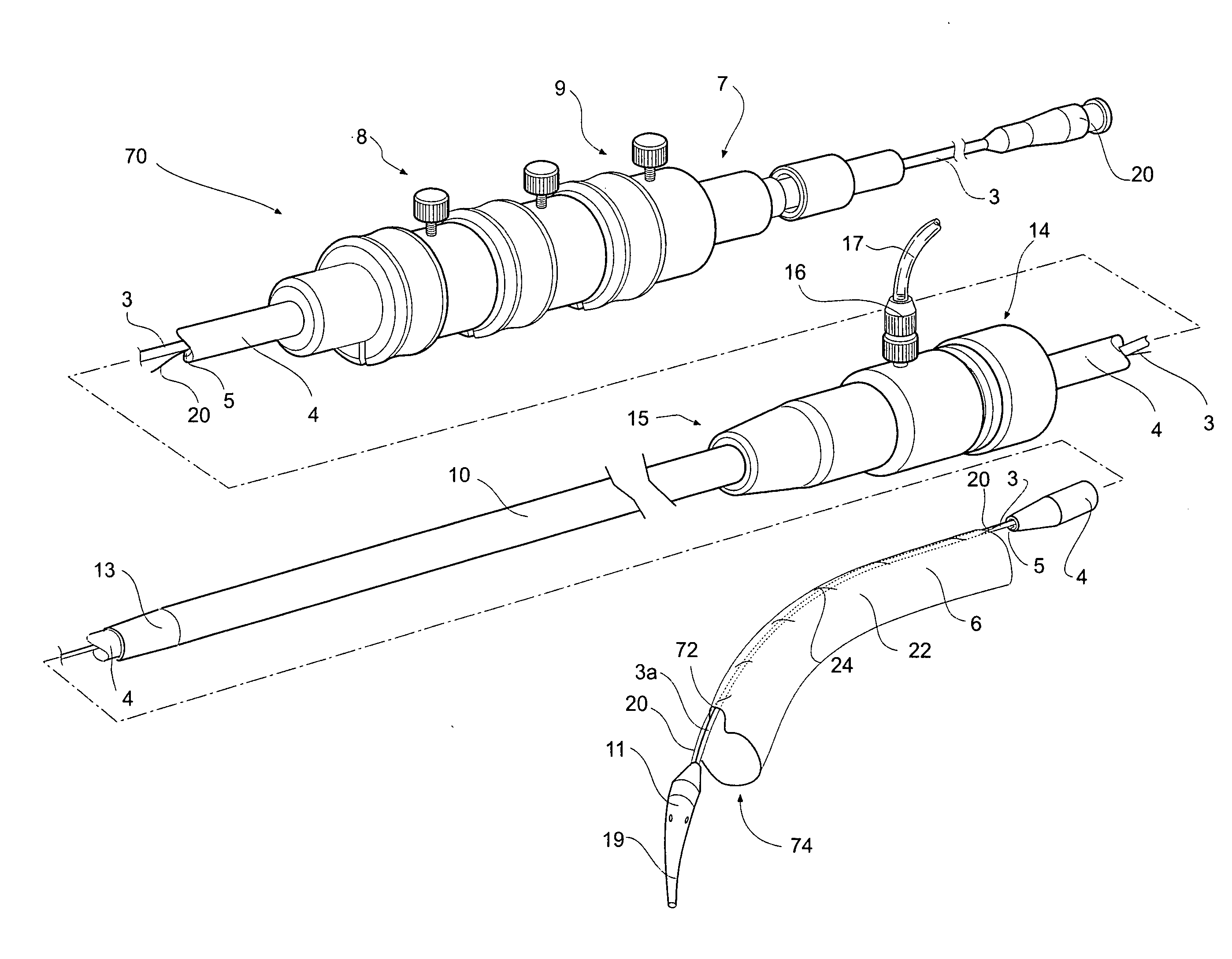 Endoluminal delivery assembly