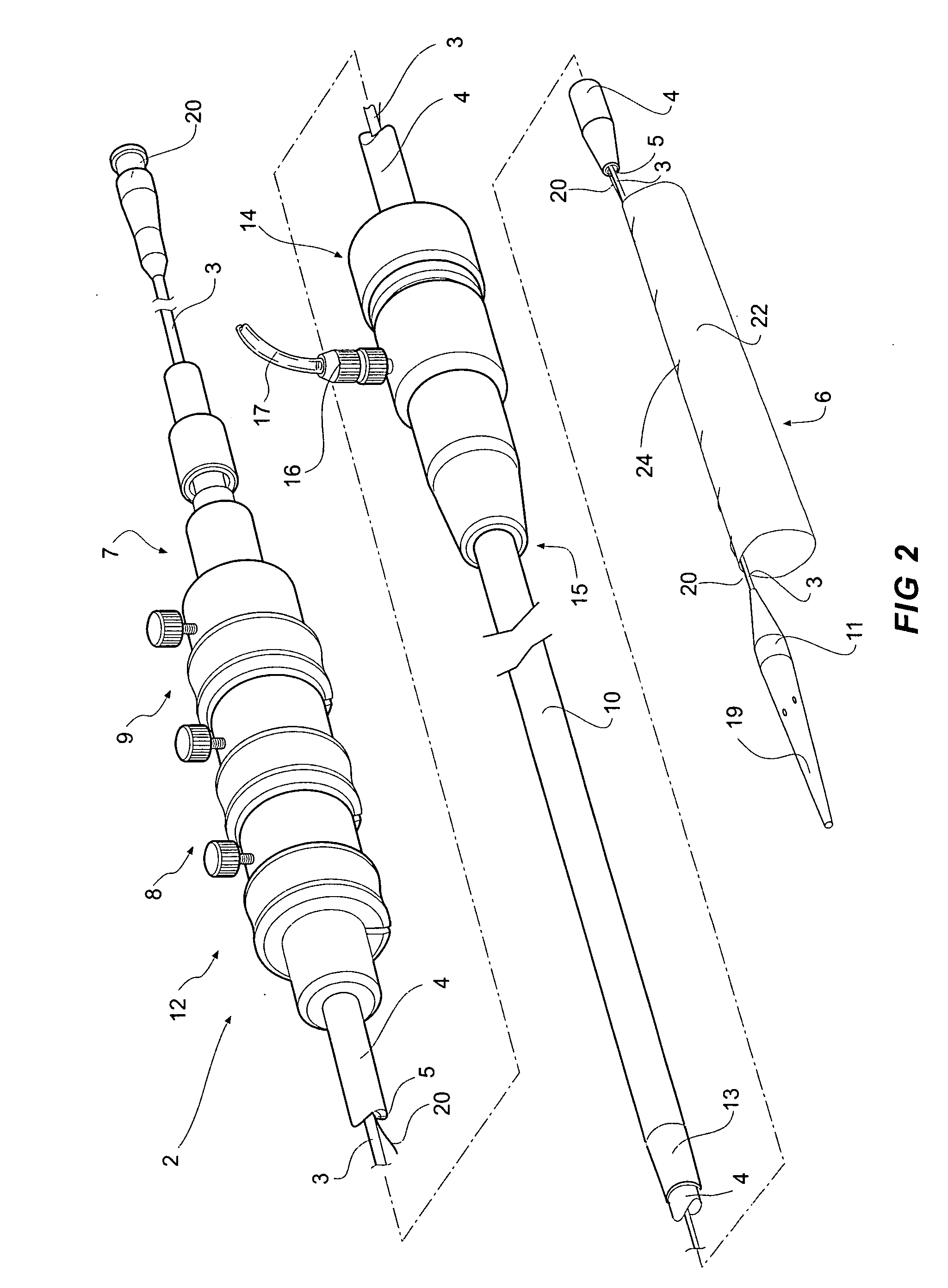 Endoluminal delivery assembly