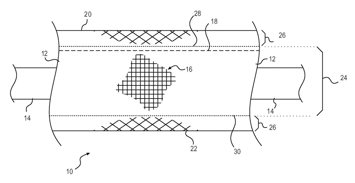 Wire casing and method of making the same