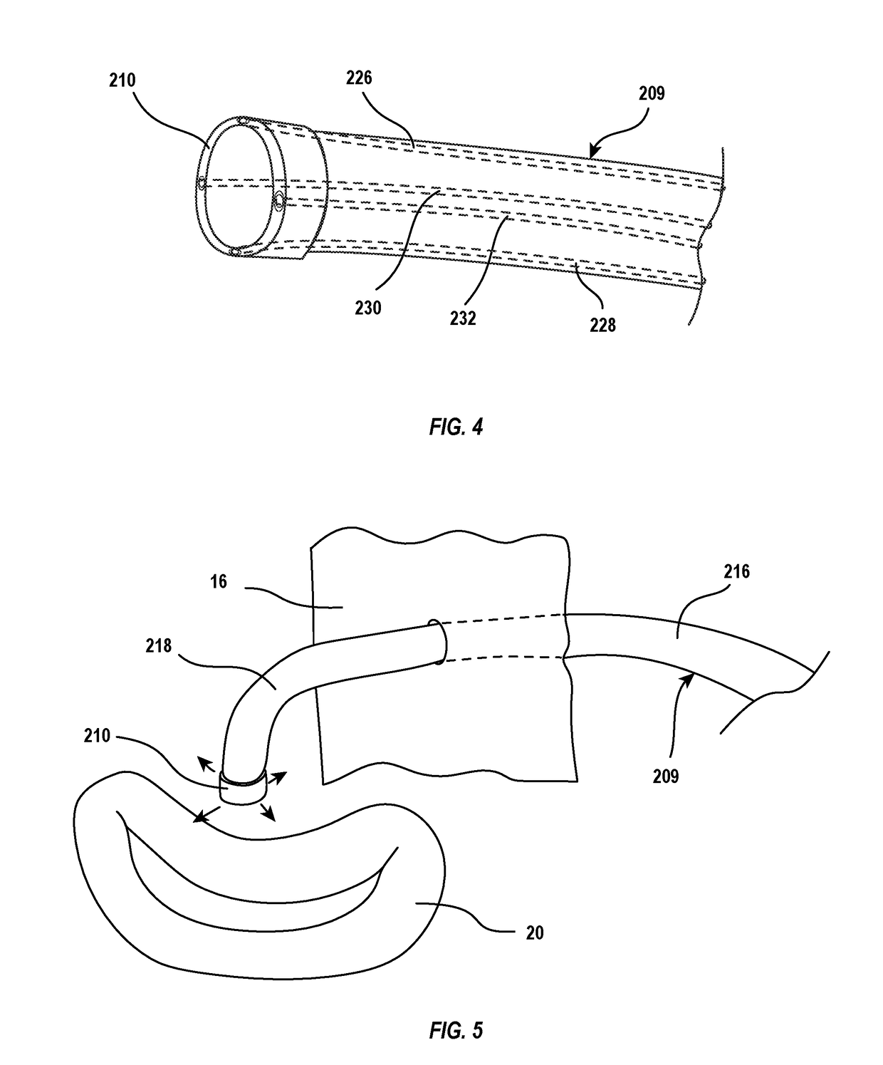 Intravascular delivery system with centralized steering