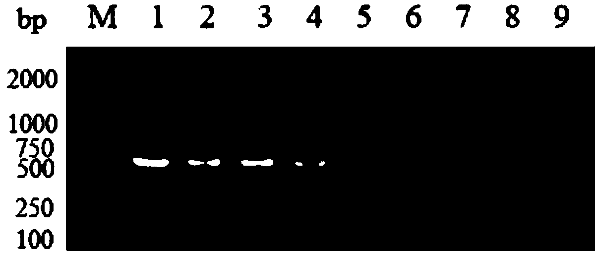 Universal type porcine deltacoronavirus nested RT-PCR detection method