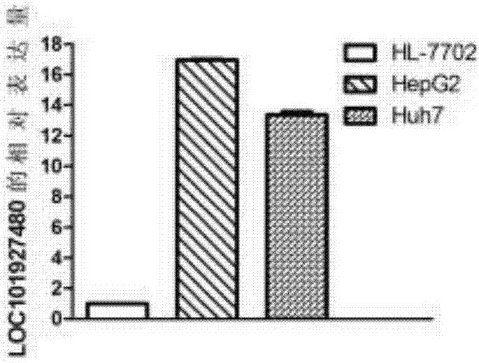 Use of lncRNA as biomarker in diagnosis and treatment of liver cancer