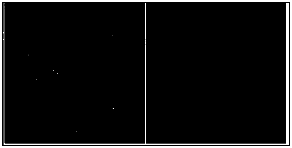 Chuanxiong rhizome oil microcapsule and preparation method thereof, and chuanxiong rhizome oil microcapsule gel patch and preparation method thereof