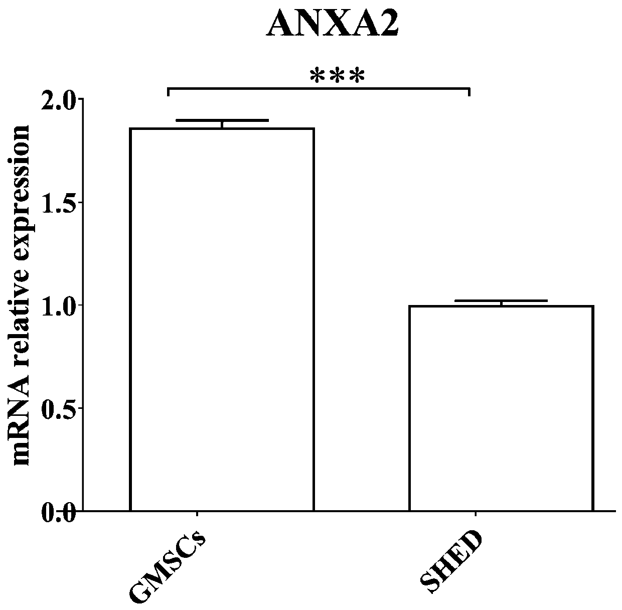 Marker for distinguishing gingival stem cells and deciduous tooth pulp stem cells and application thereof