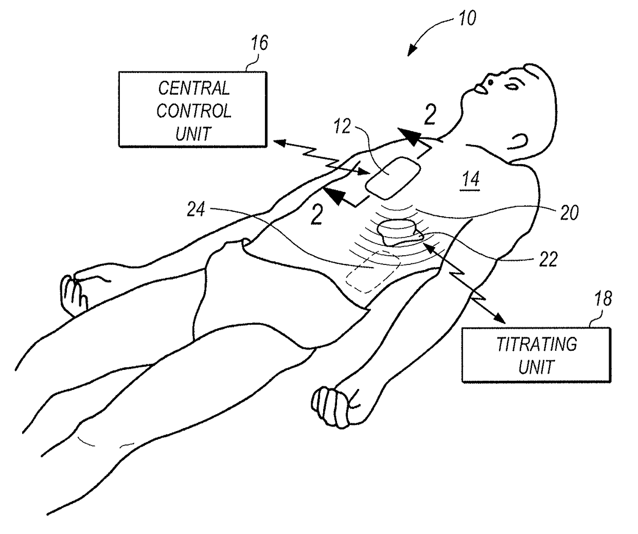 System and method for titrating in vivo cellular reaction and gene expression using varying oscillation frequencies