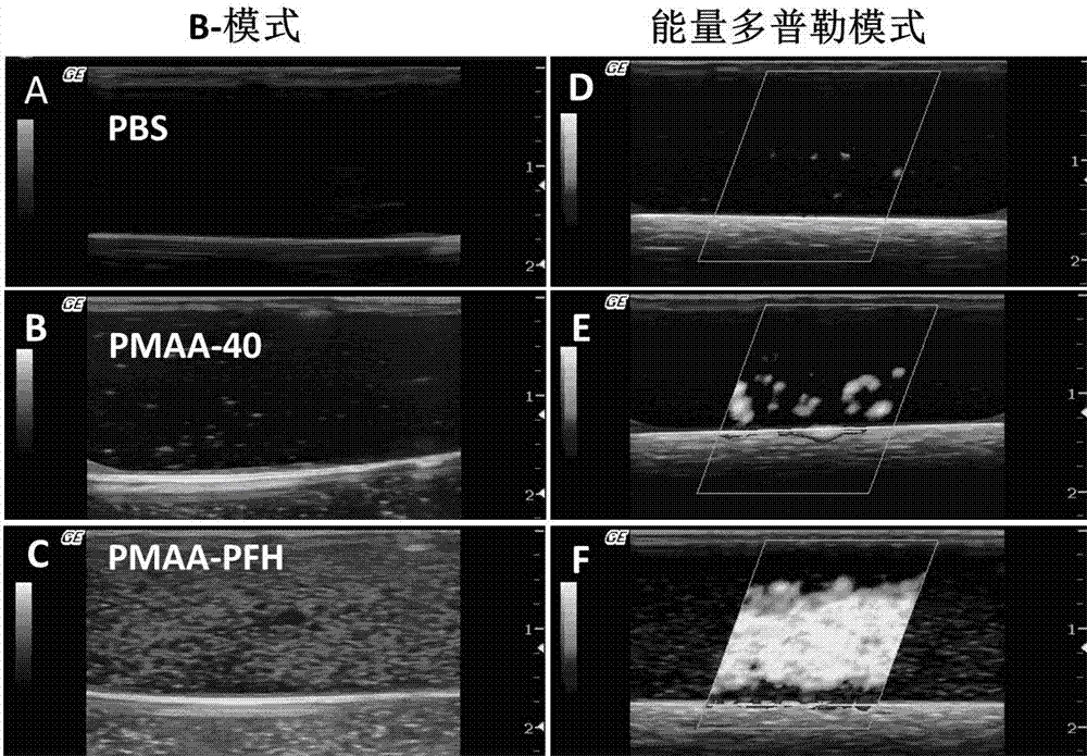 Preparation method and use of degradable polymer nano-microcapsules