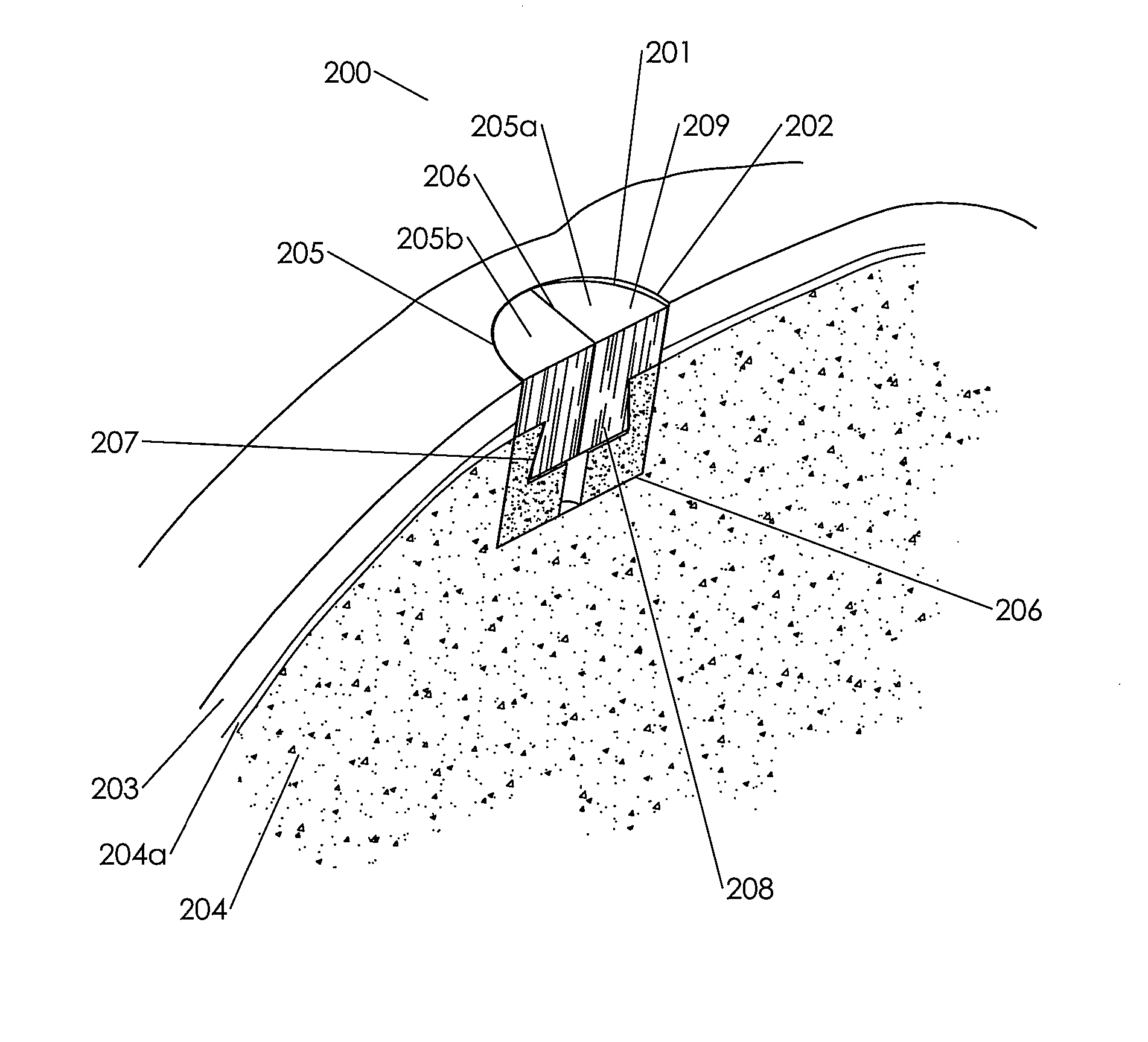 Assembled cartilage repair graft