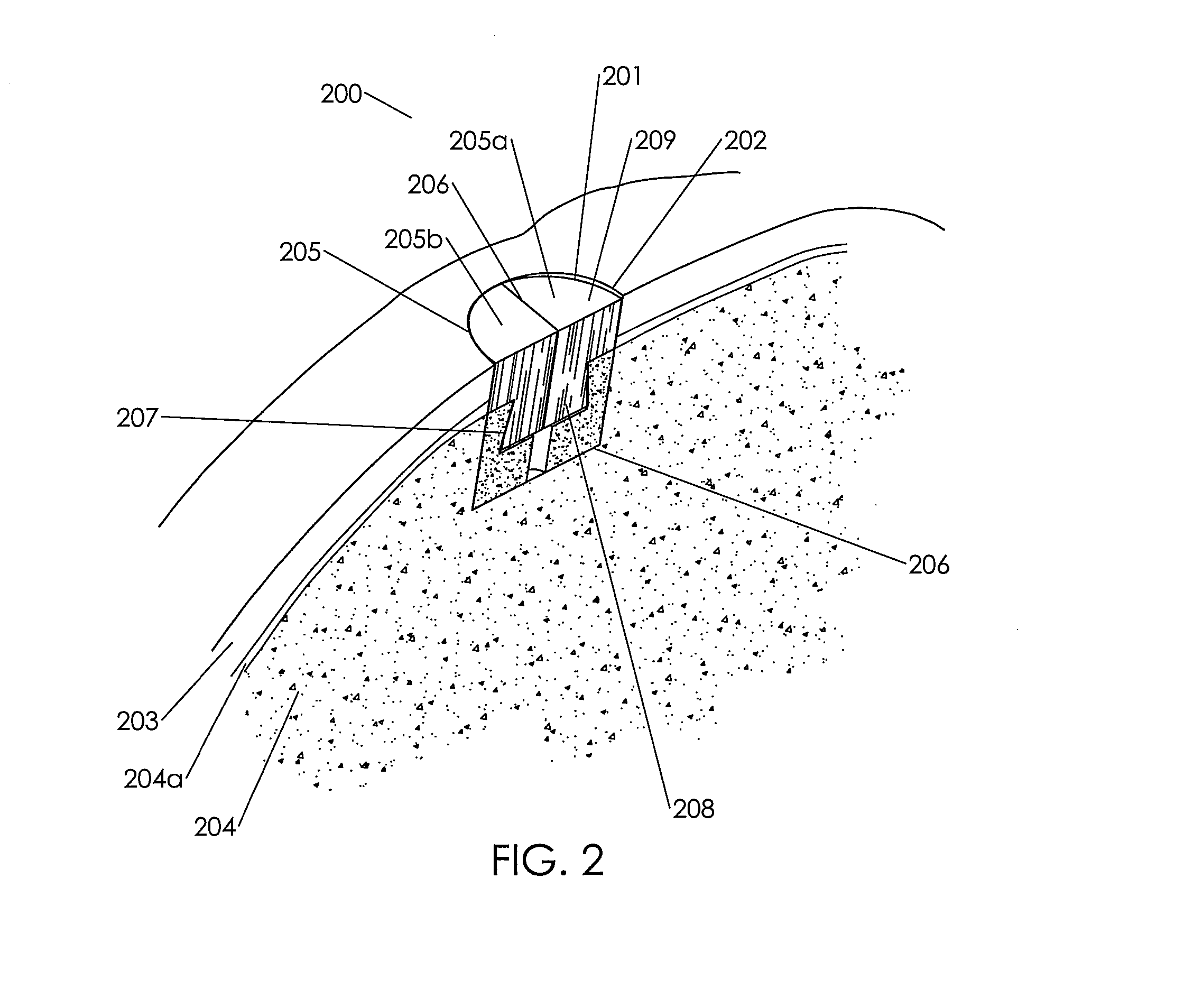 Assembled cartilage repair graft