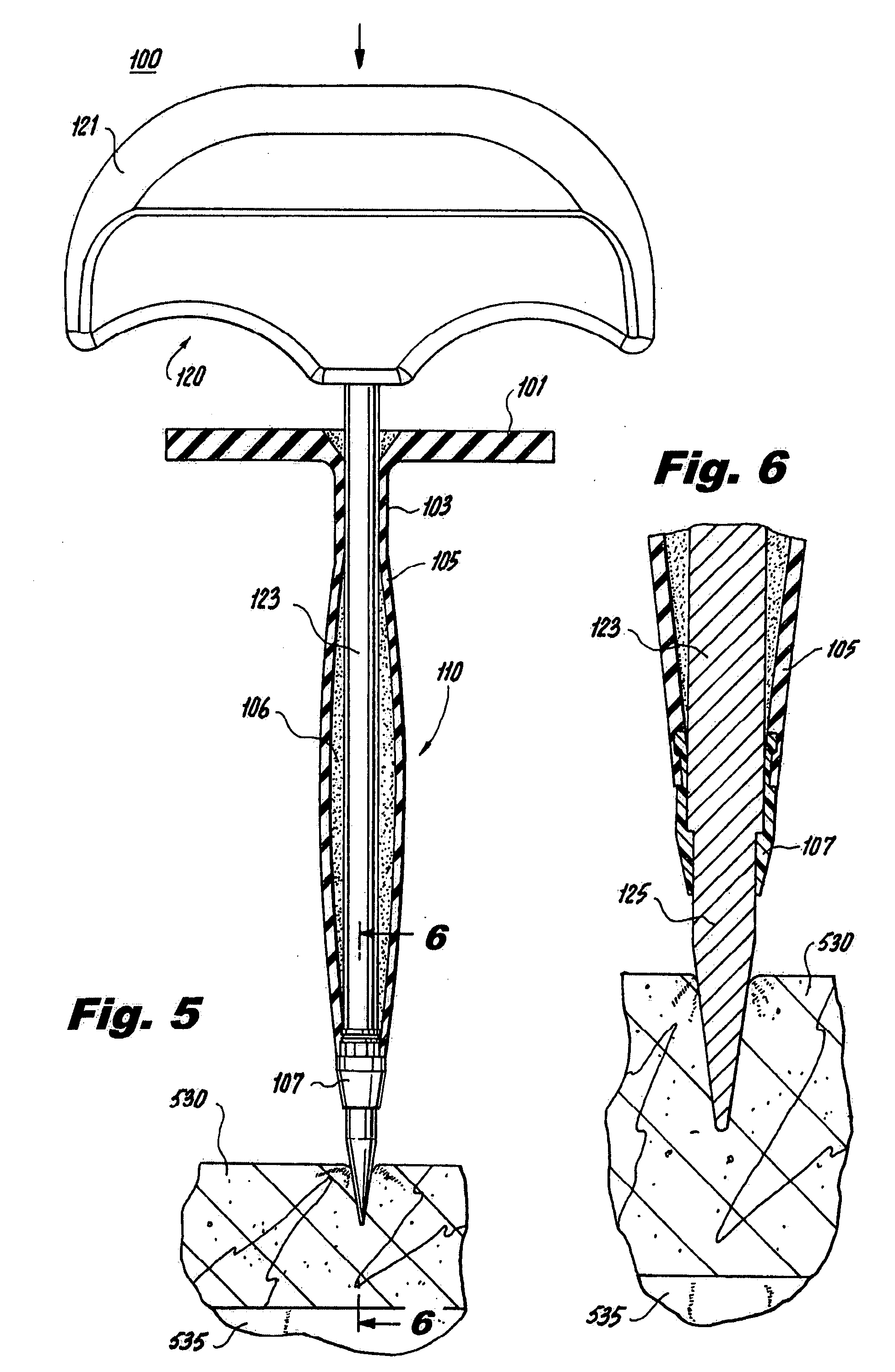 Elastically deformable surgical access device having telescoping guide tube