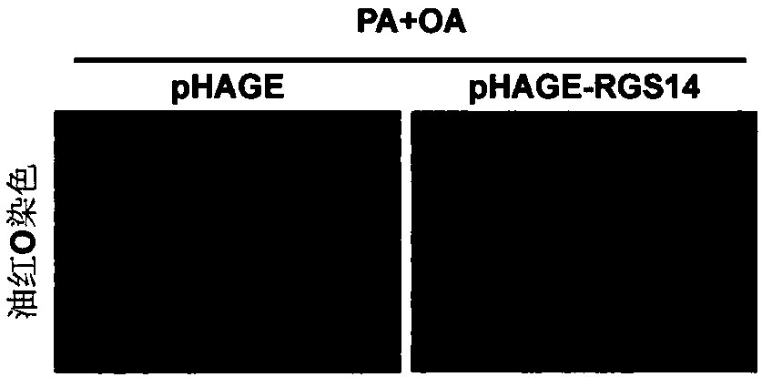 Application of protein signal transduction regulatory factor 14 in preparation of drugs for treating fatty liver and related diseases