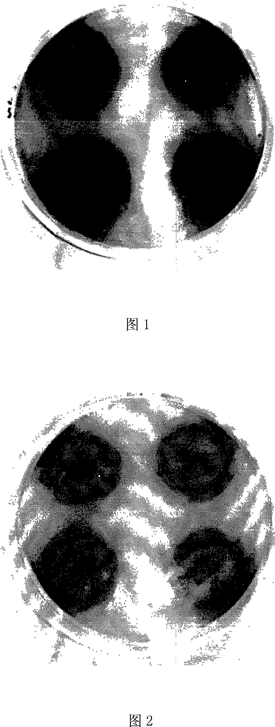 Flat-plate sieving method of aesculin for high-yield beta-glucosidase producing strain