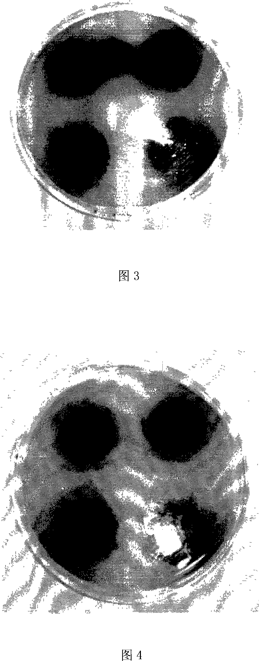 Flat-plate sieving method of aesculin for high-yield beta-glucosidase producing strain