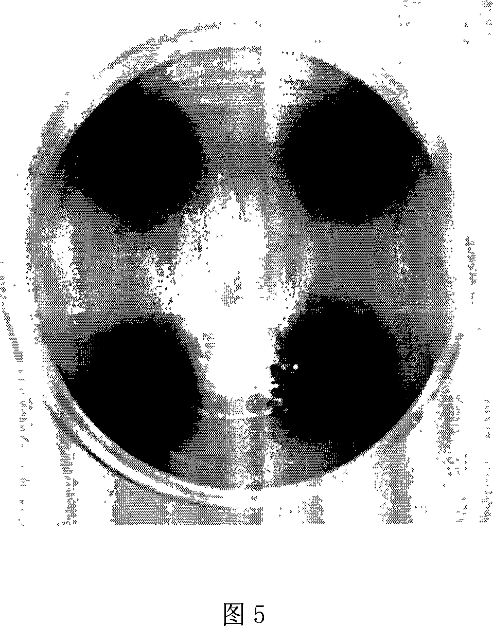 Flat-plate sieving method of aesculin for high-yield beta-glucosidase producing strain