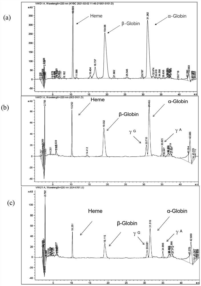 Lentivirus carrying erythroid gene editing system and medicine