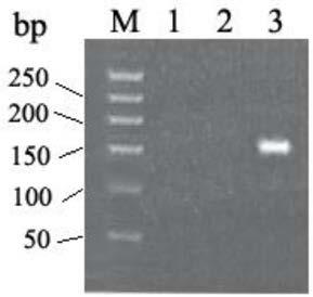 BRCA1 gene g. 43063754T)G mutant and application thereof in breast cancer auxiliary diagnosis