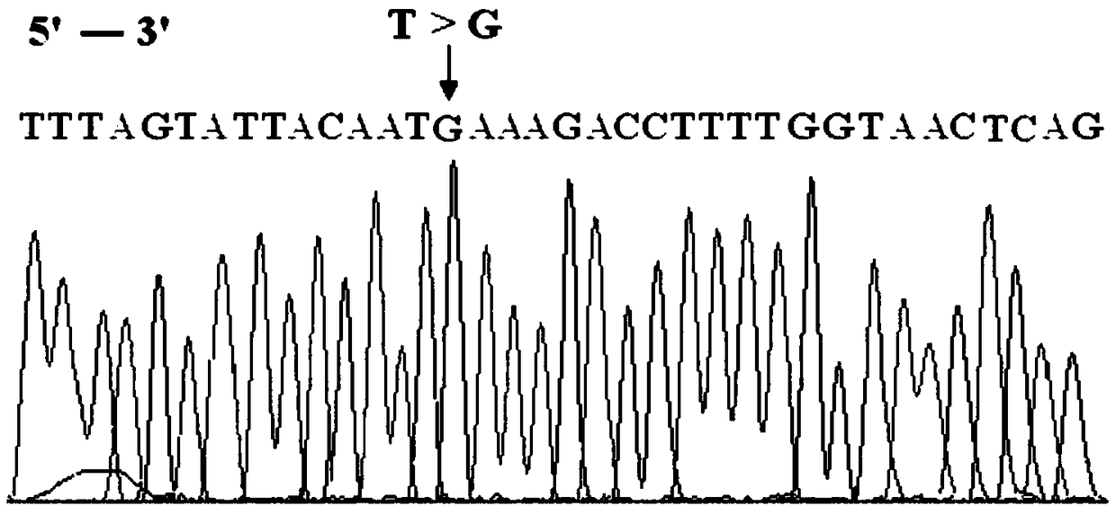 BRCA1 gene g. 43063754T)G mutant and application thereof in breast cancer auxiliary diagnosis