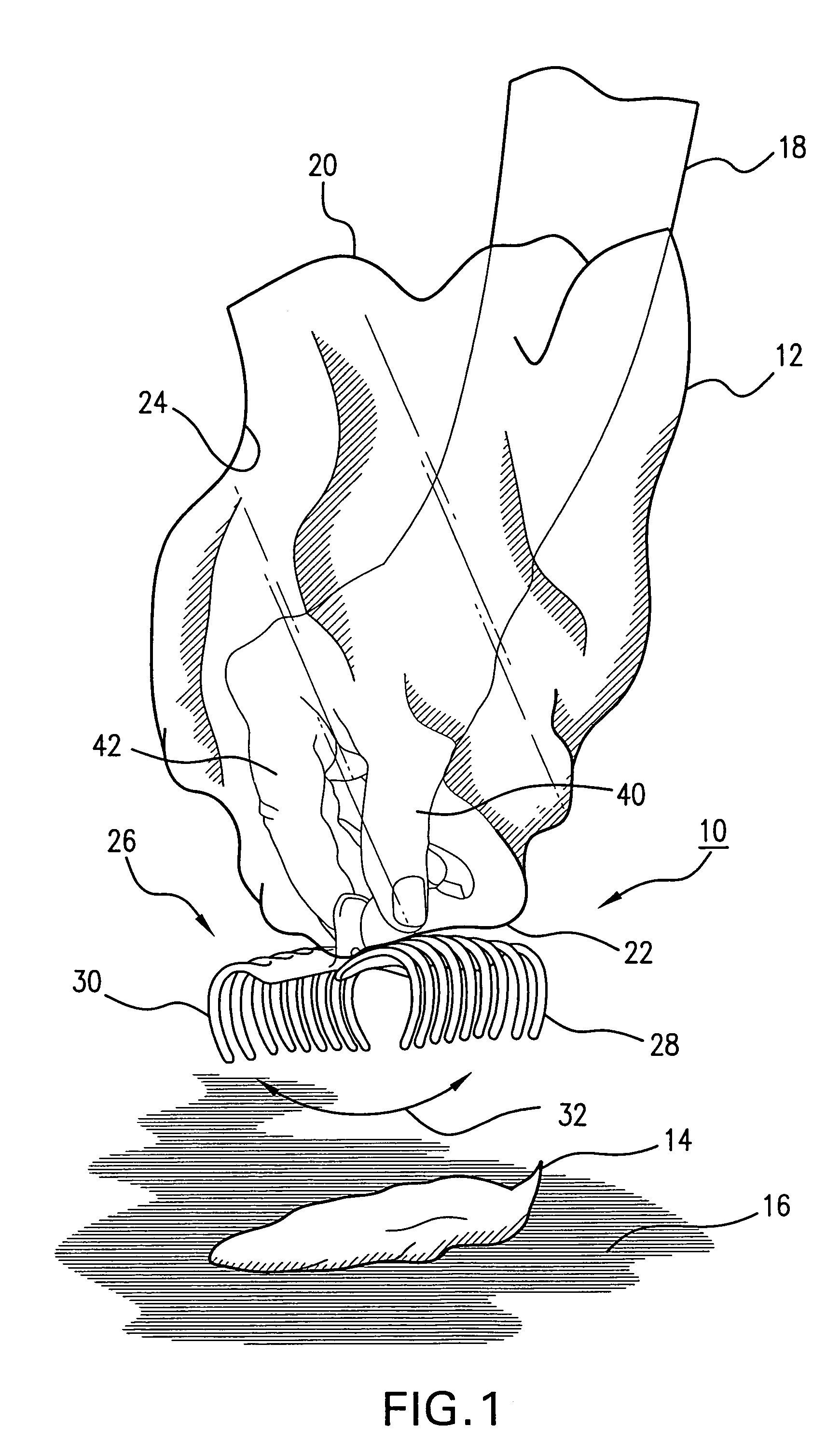 Refuse removal system and method for removing refuse