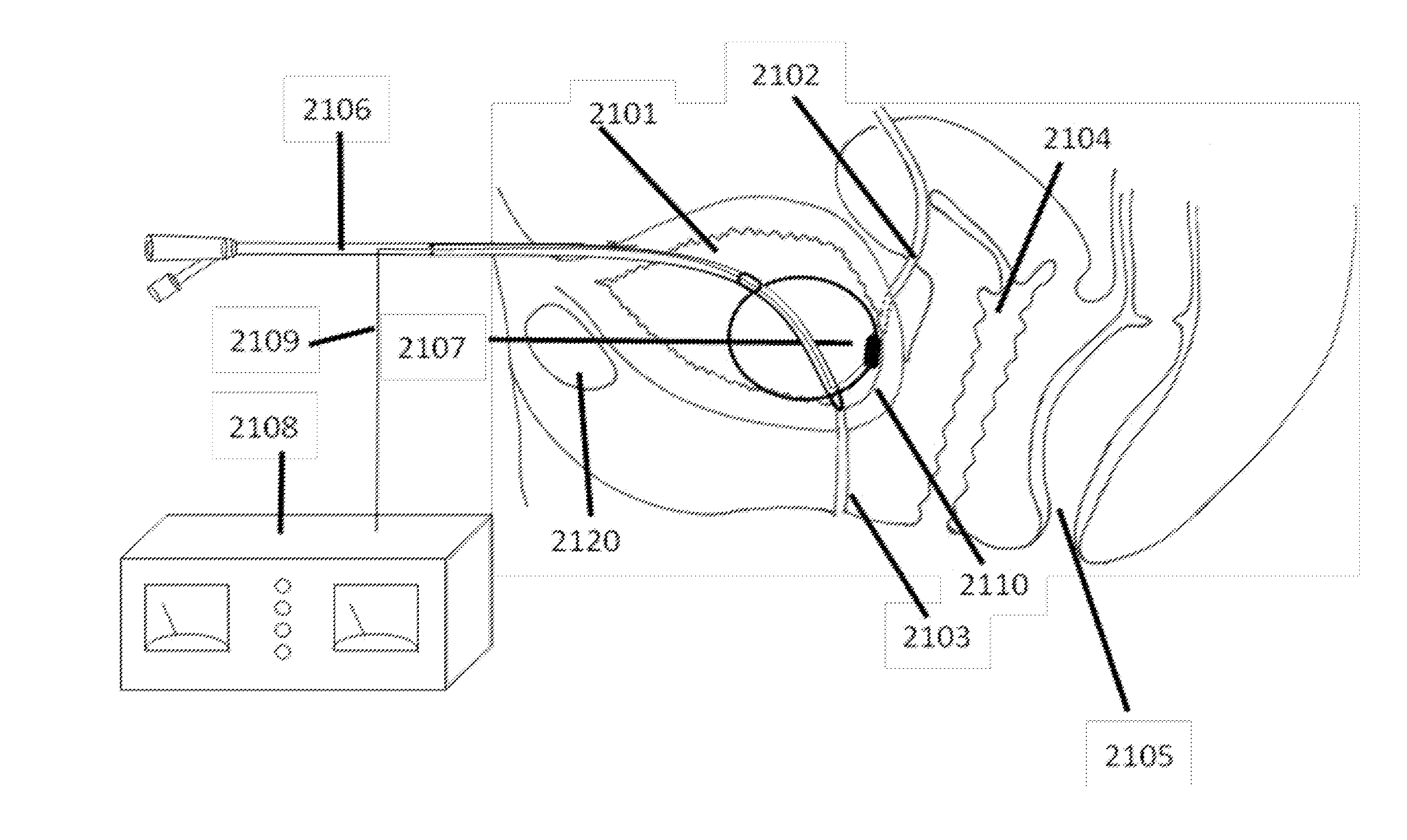 Stimulation of the urinary system