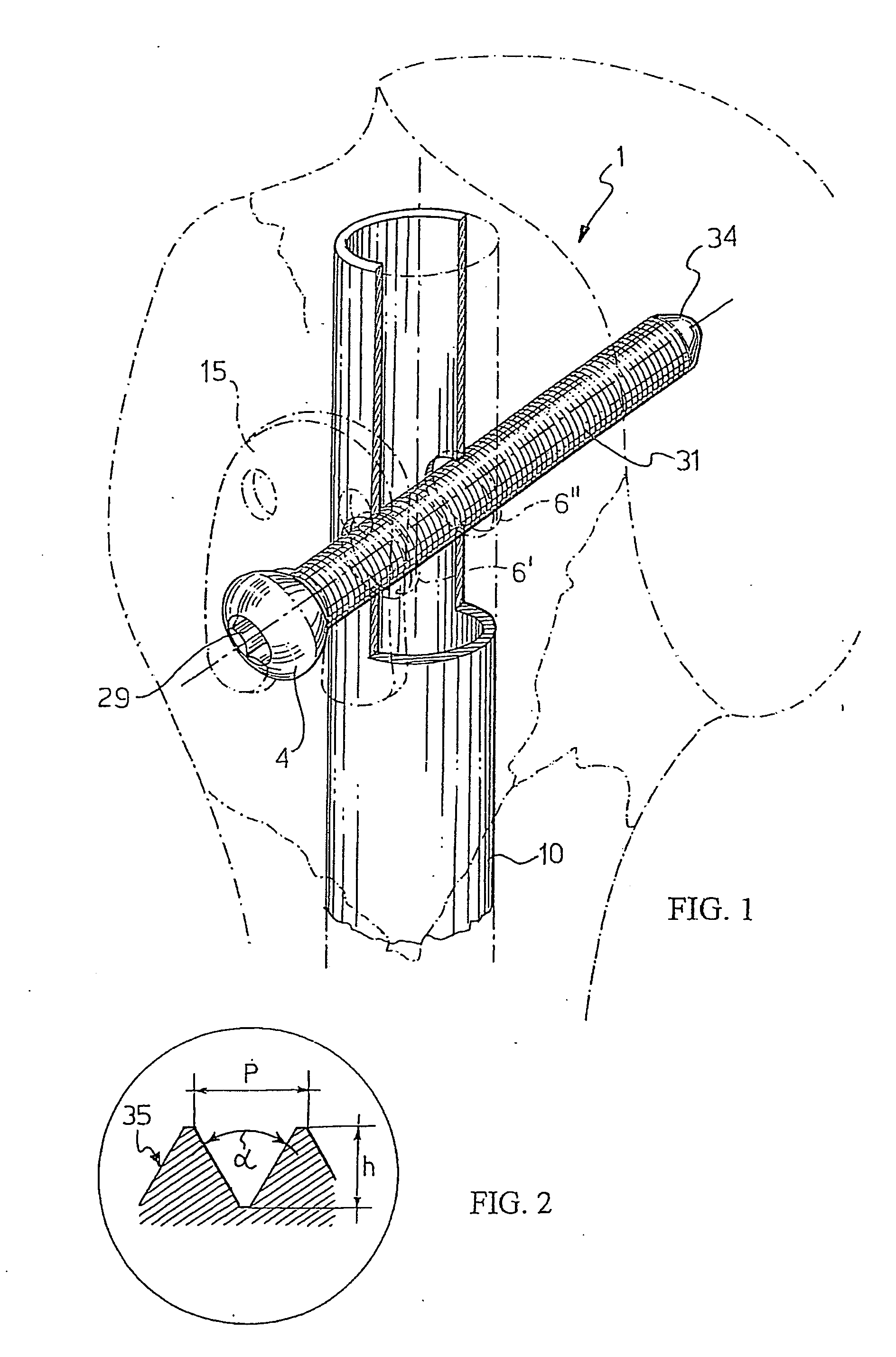 Surgical nail and screw fixation system