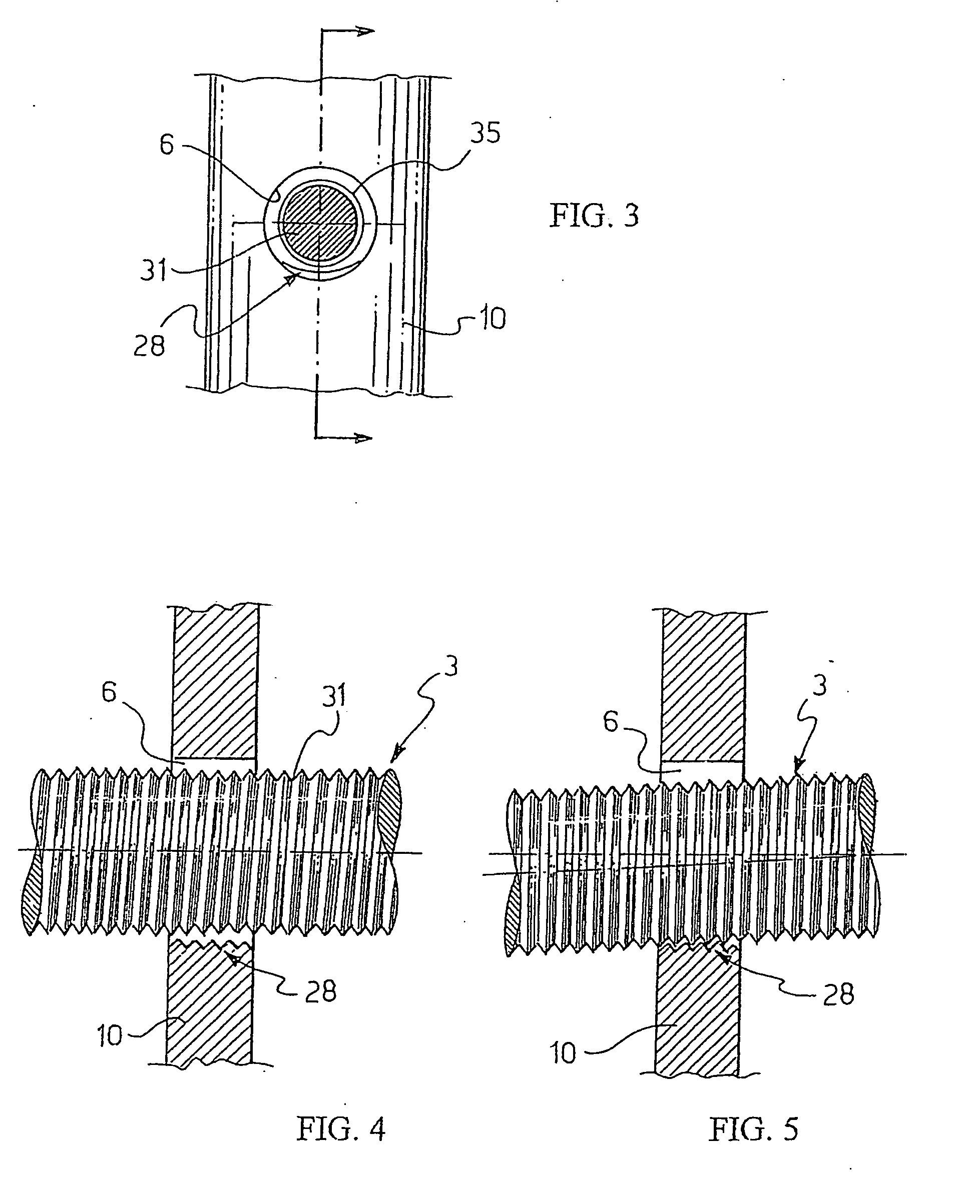 Surgical nail and screw fixation system