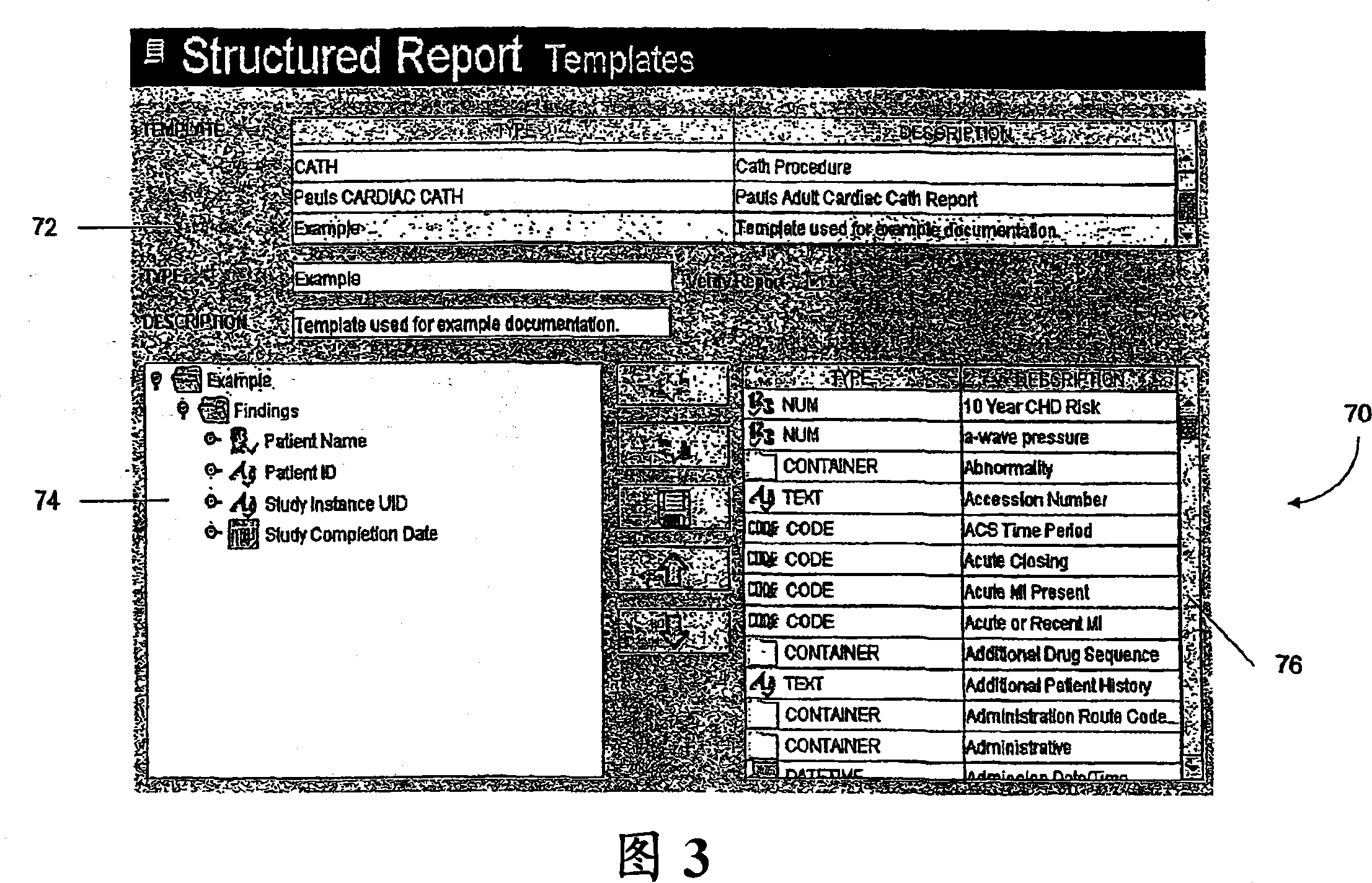 Generalized approach to structured medical reporting