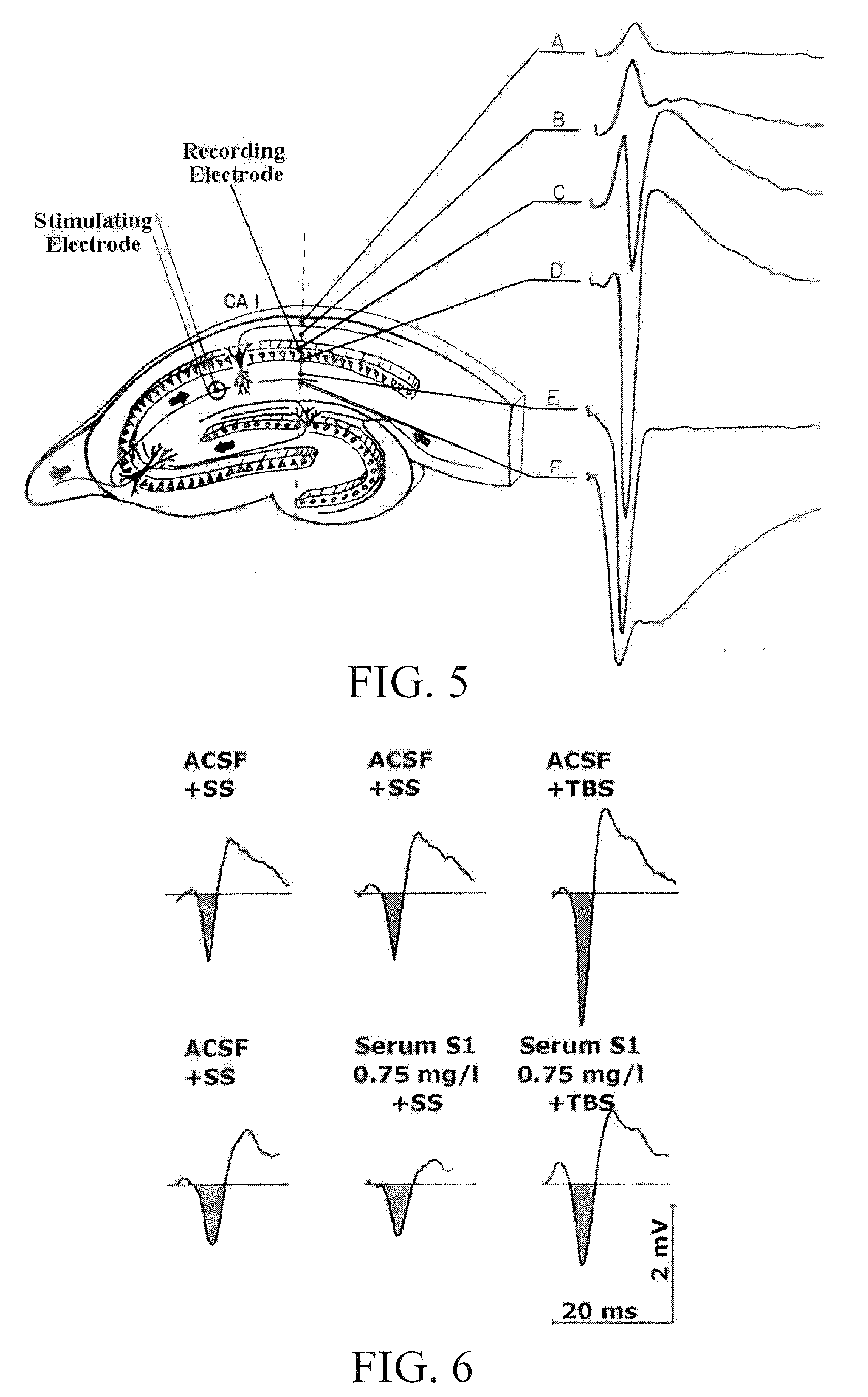 Use of a Biologically Active Blood Serum for the Treatment of a Disorder Characterized in a Reduced Function of a GABA Receptor