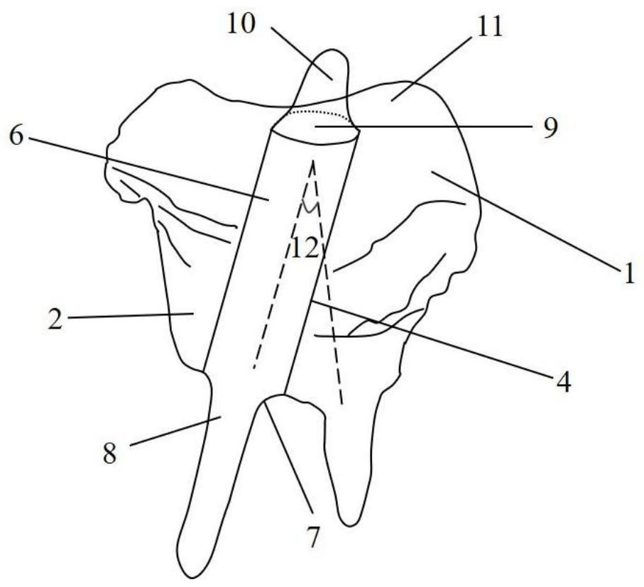 Plug-type post-core integrated crown suitable for posterior tooth occlusal gingival restoration with space less than 3 mm