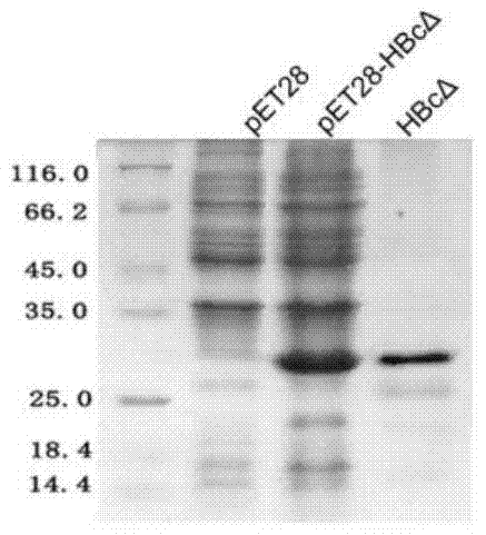 Connective tissue growth factor chimeric vaccine for treating liver fibrosis and its application