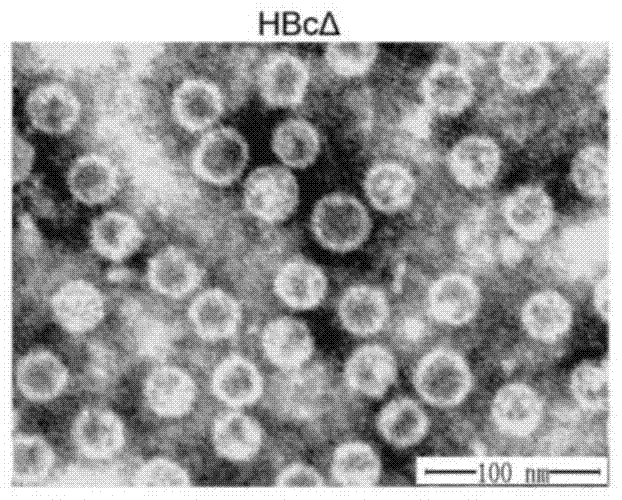 Connective tissue growth factor chimeric vaccine for treating liver fibrosis and its application