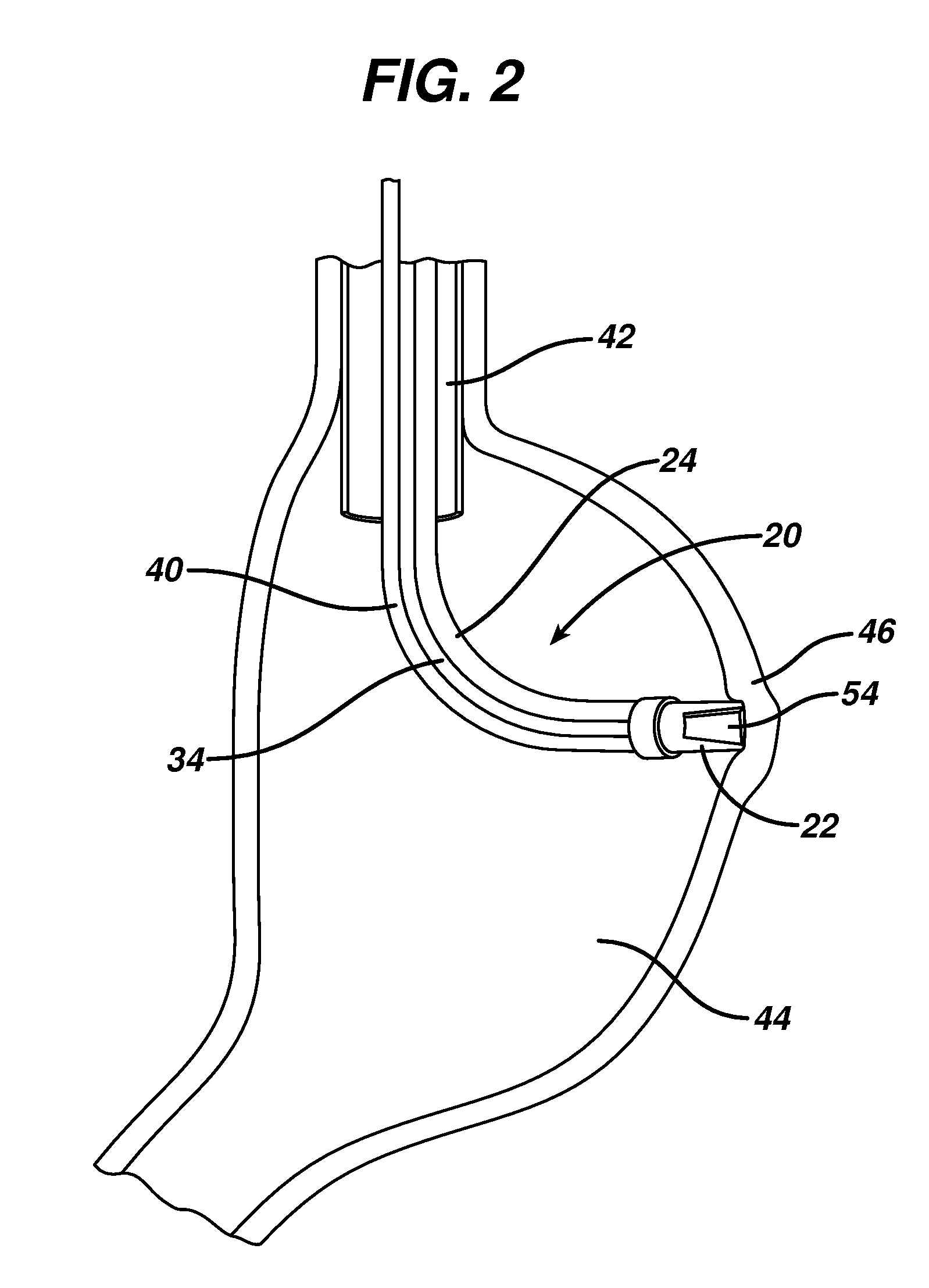 Method for plicating and fastening gastric tissue