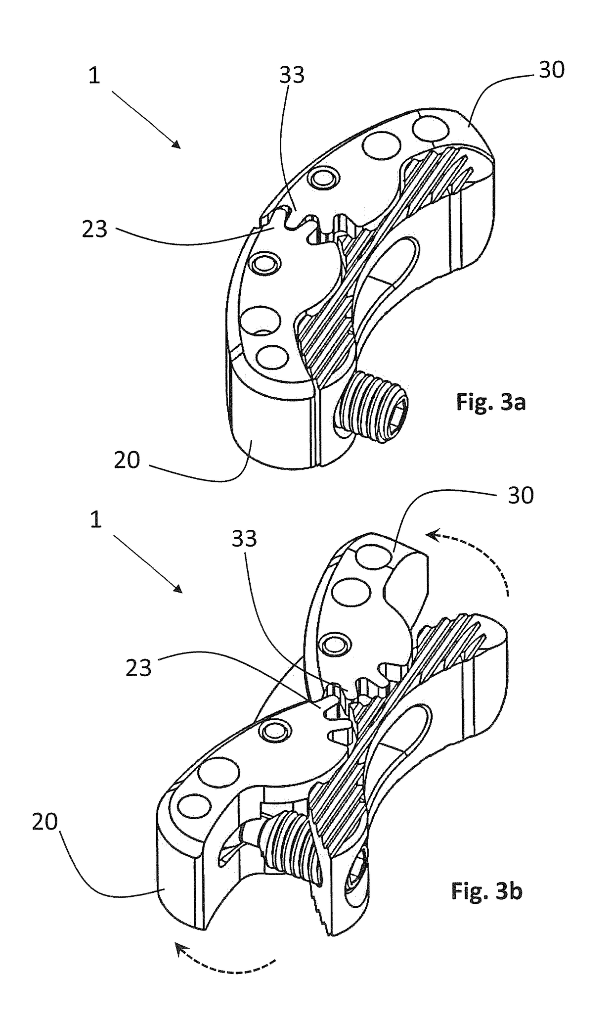 Expandable spinal implant