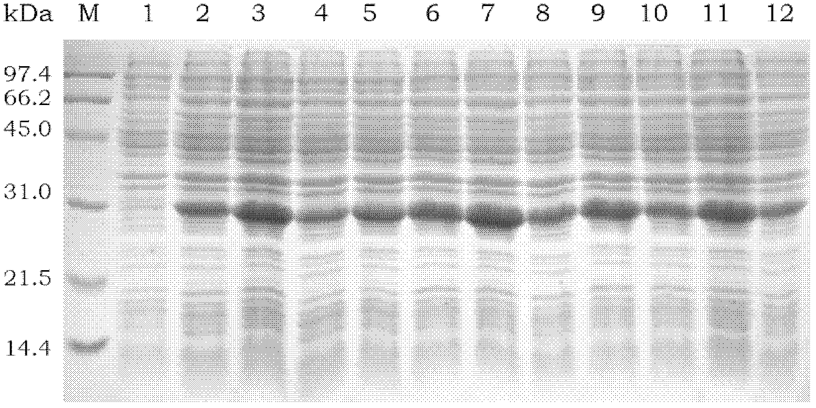 Enterovirus 71 type specific recombinant protein antigen and application thereof