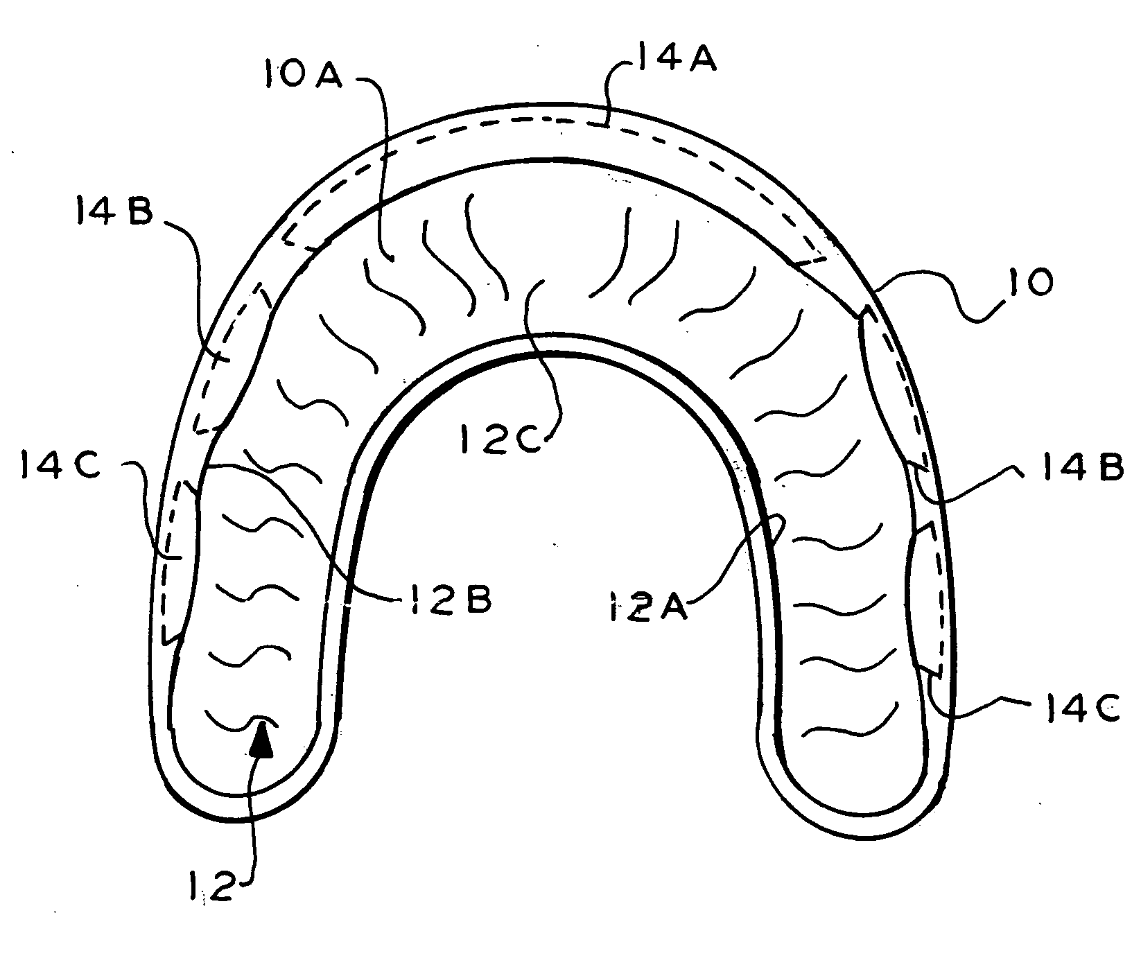 Therapeutic and protective dental device useful as an intra-oral delivery system