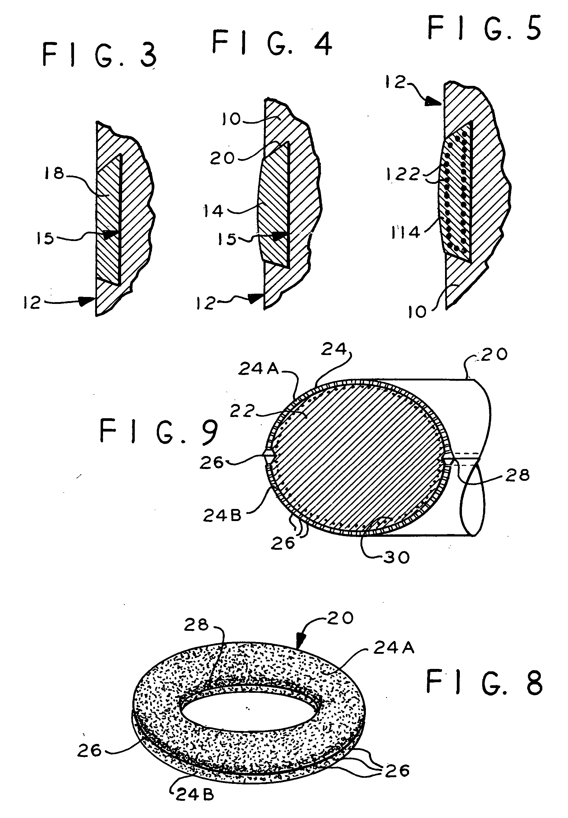 Therapeutic and protective dental device useful as an intra-oral delivery system