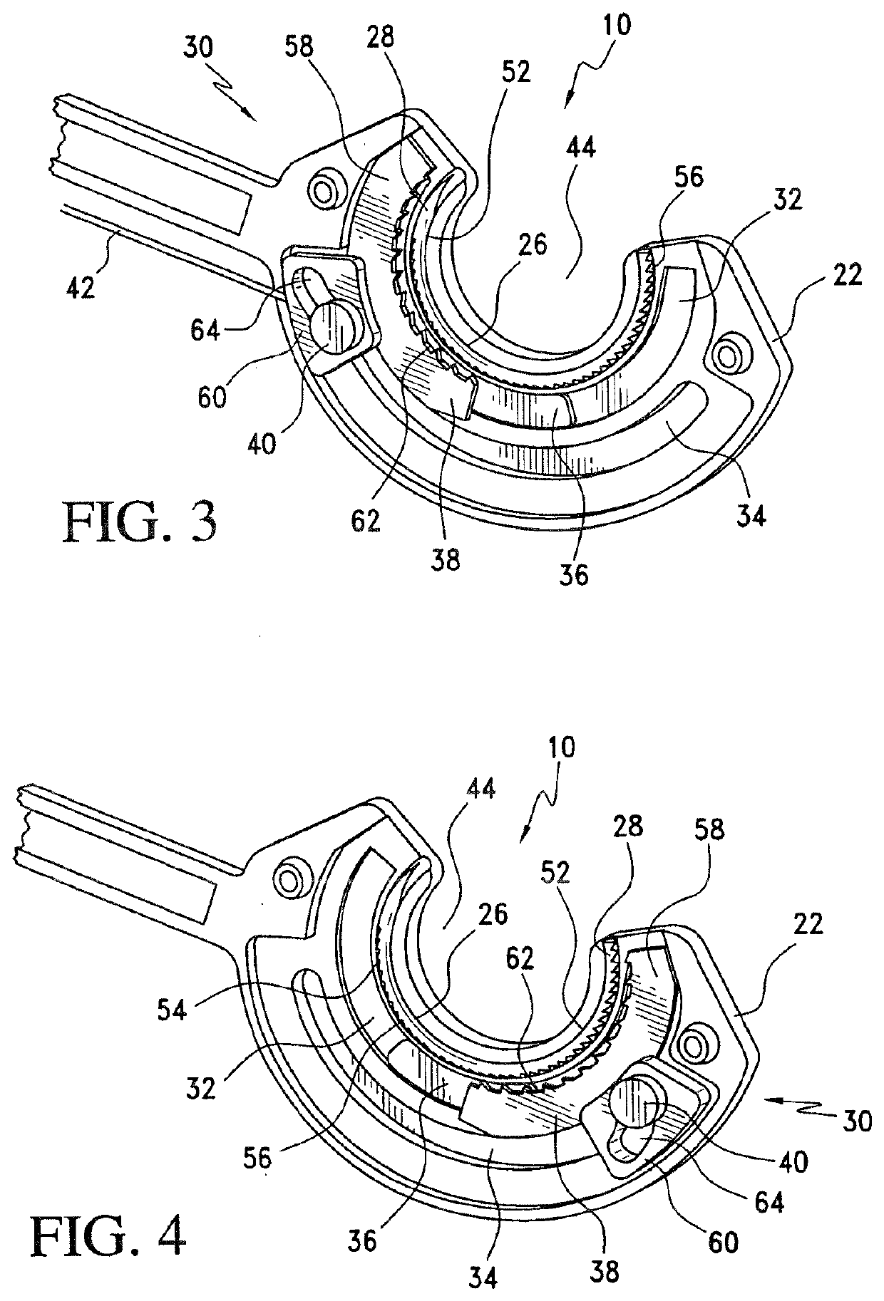 Method for suture lacing