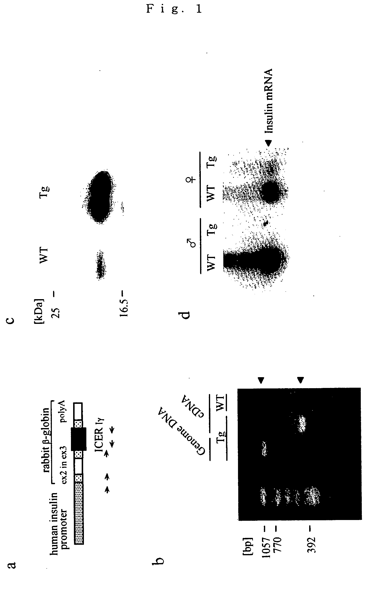 Nephropathy-associated gene