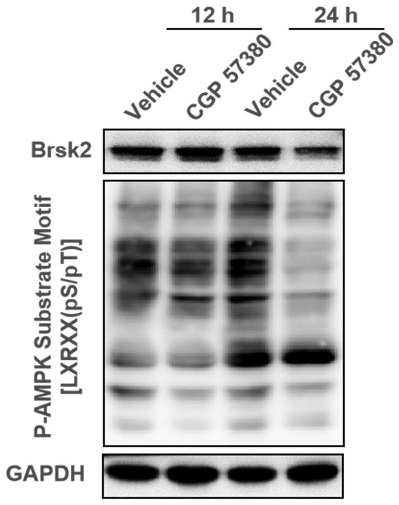 Application of CGP 57380 in preparation of medicine for preventing or treating type 2 diabetes