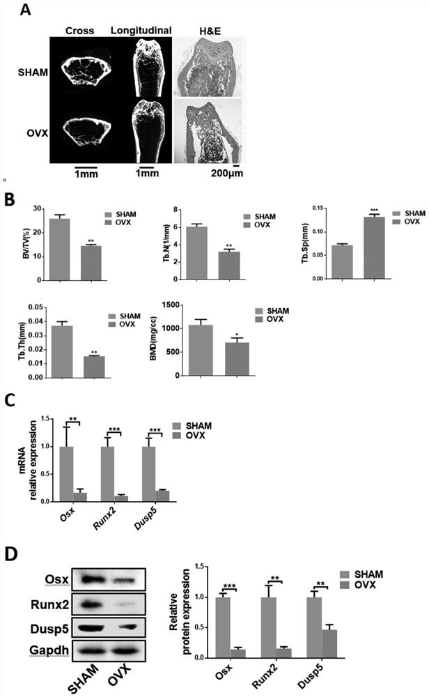 Application of DUSP5 in preparation of medicine for preventing, relieving and/or treating osteoporosis