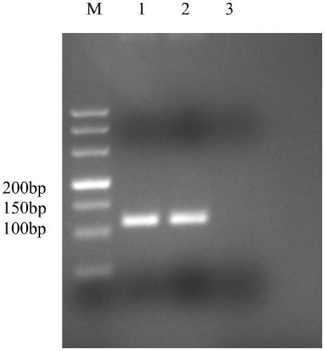 Primer set, reagent, kit and detection method for detecting and/or assisting detection of GI type norovirus