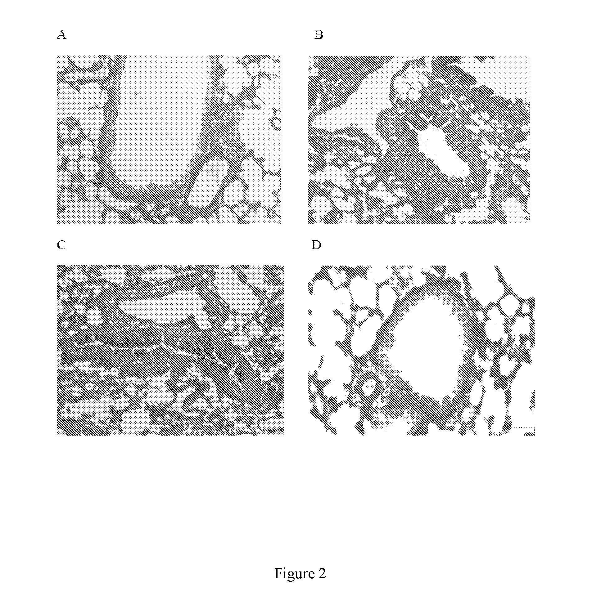 Vaccine for Prophylaxis or Treatment of an Allergen-Driven Airway Pathology