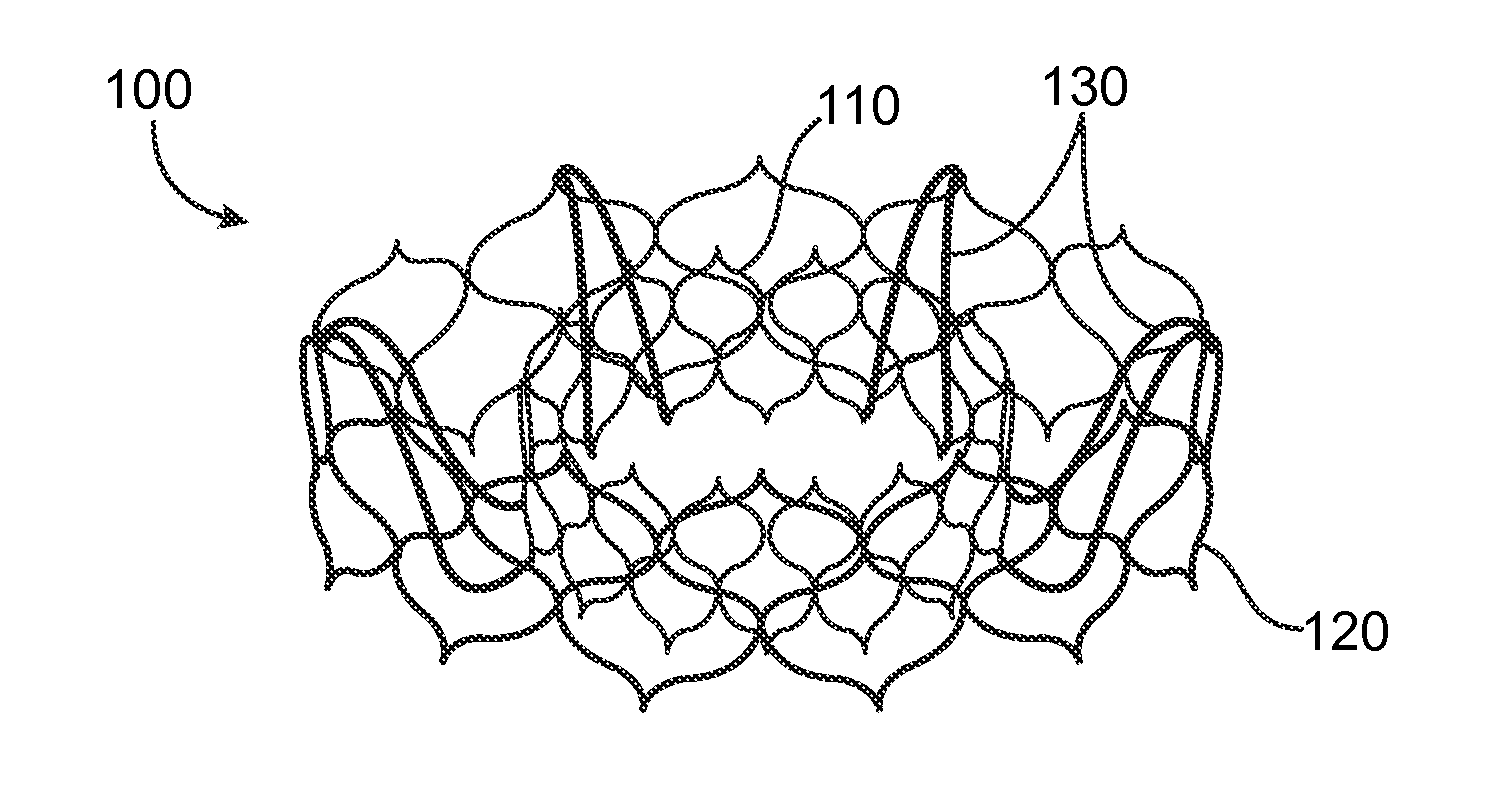 Valve Prosthesis and Method for Delivery